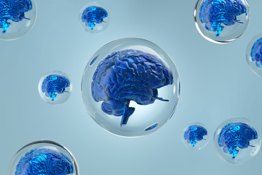 Artificial Intelligence Bubble.