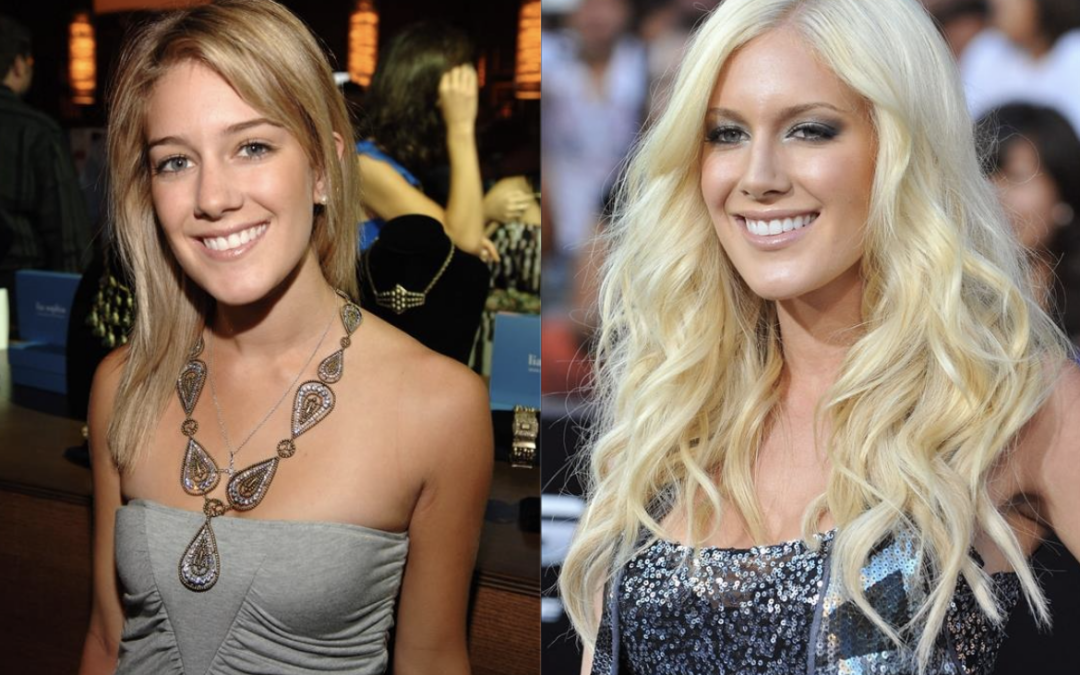 This celebrity had 10 cosmetic surgeries in one day – but the reaction now is more shocking